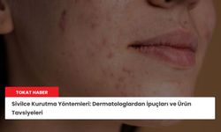 Sivilce Kurutma Yöntemleri: Dermatologlardan İpuçları ve Ürün Tavsiyeleri