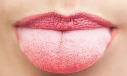 Dilde Beyazlık: Nedenleri ve Vitamin Eksikliklerinin Etkisi