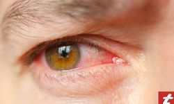 Göz Enfeksiyonlarına Doğal Çözümler: Evde Uygulanabilecek Bitkisel Tedavi Yöntemleri