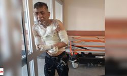 Engelli Adamın Telefonunu Gasp Etti, Şikayet Edince Üzerine Benzin Döktü Yaktı