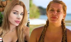 Survivor’dan Diskalifiye Edilen Almeda Baylan 29 Kilo Verdi, Estetikle Şaşırttı: Şimdi de Boşanıyor