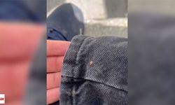 Tokat’ta Kene Alarmı: Genç Vatandaş Üzerindeki Keneyi Son Anda Fark Etti
