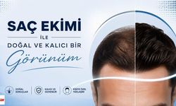 Saç ekimi nasıl yapılır?