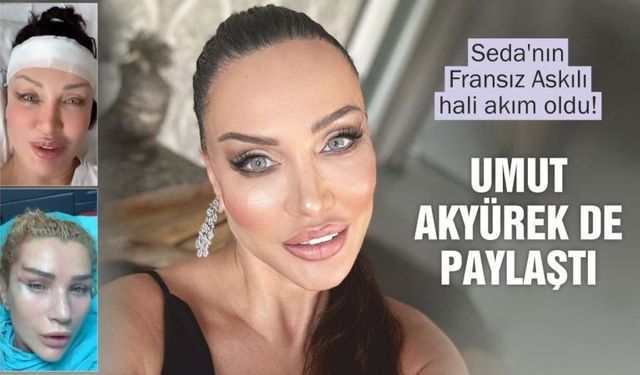 Seda Sayan'ın başlattığı akıma o da uydu