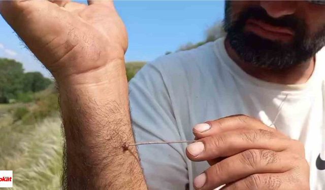 Tokat'ta 5 kişi KKKA hastalığı teşhisiyle tedavi görüyor