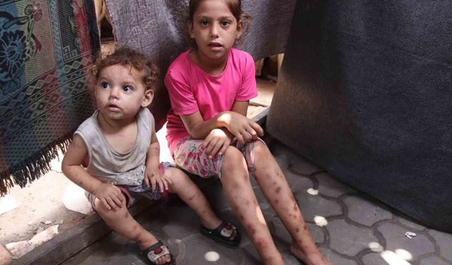Gazze'de alarm büyüyor, iki haftada 9 bin 300 çocuk ve yetişkin suçiçeğine yakalandı