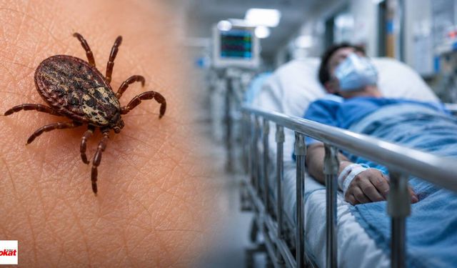 Kene Tehlikesi Sadece KKKA Değil: Ciltteki Bu Görüntü Alarm İşareti Olabilir