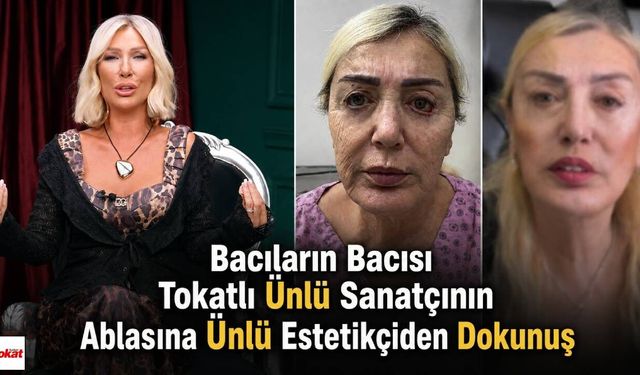 Bacıların Bacısı Tokatlı Ünlü Sanatçının Ablasına Ünlü Estetikçiden Dokunuş