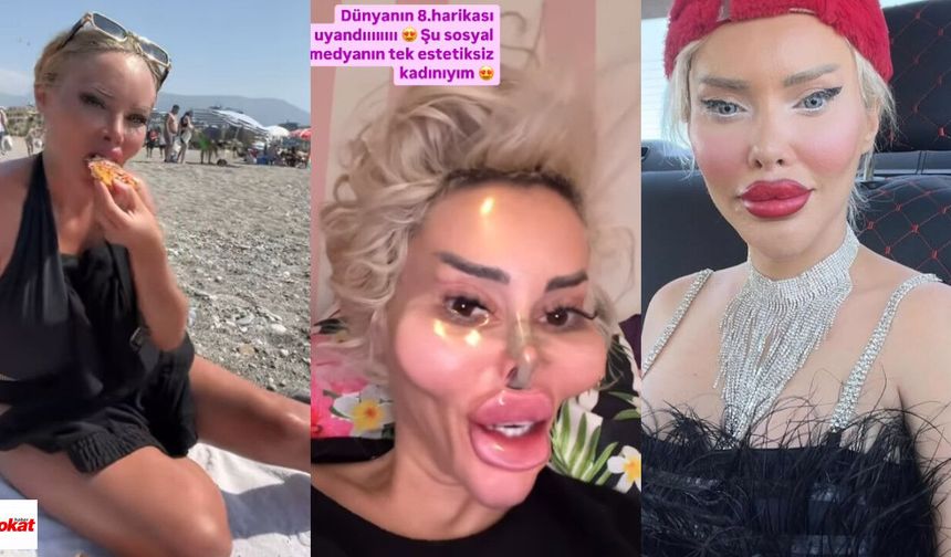 Pınar Özkurteller estetiksiz hali nasıl? Yemekteyiz Pınar kimdir?