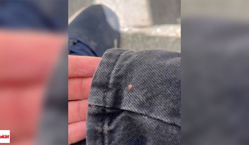 Tokat’ta Kene Alarmı: Genç Vatandaş Üzerindeki Keneyi Son Anda Fark Etti