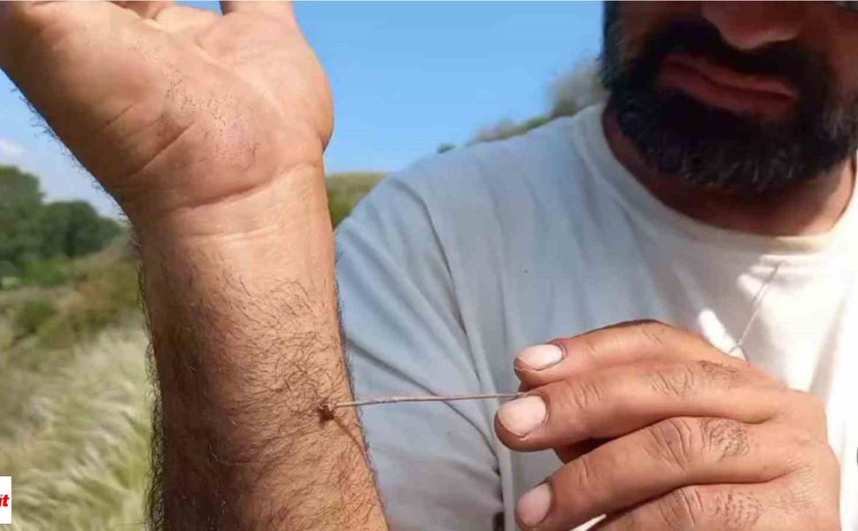 Tokat'ta 5 kişi KKKA hastalığı teşhisiyle tedavi görüyor