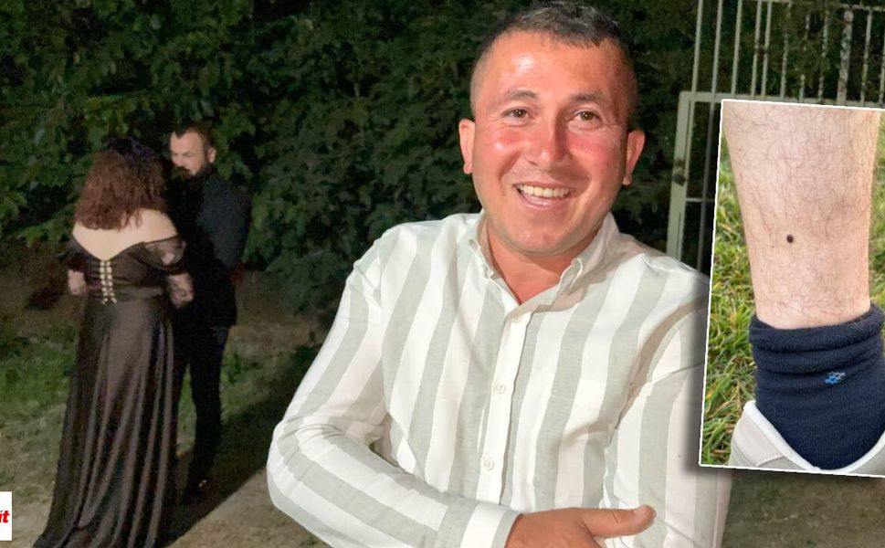 Tokat'ta Şaşırtan Olay: Bacağındaki Keneyle Hastane Yerine Yüzük Takmaya Gitti