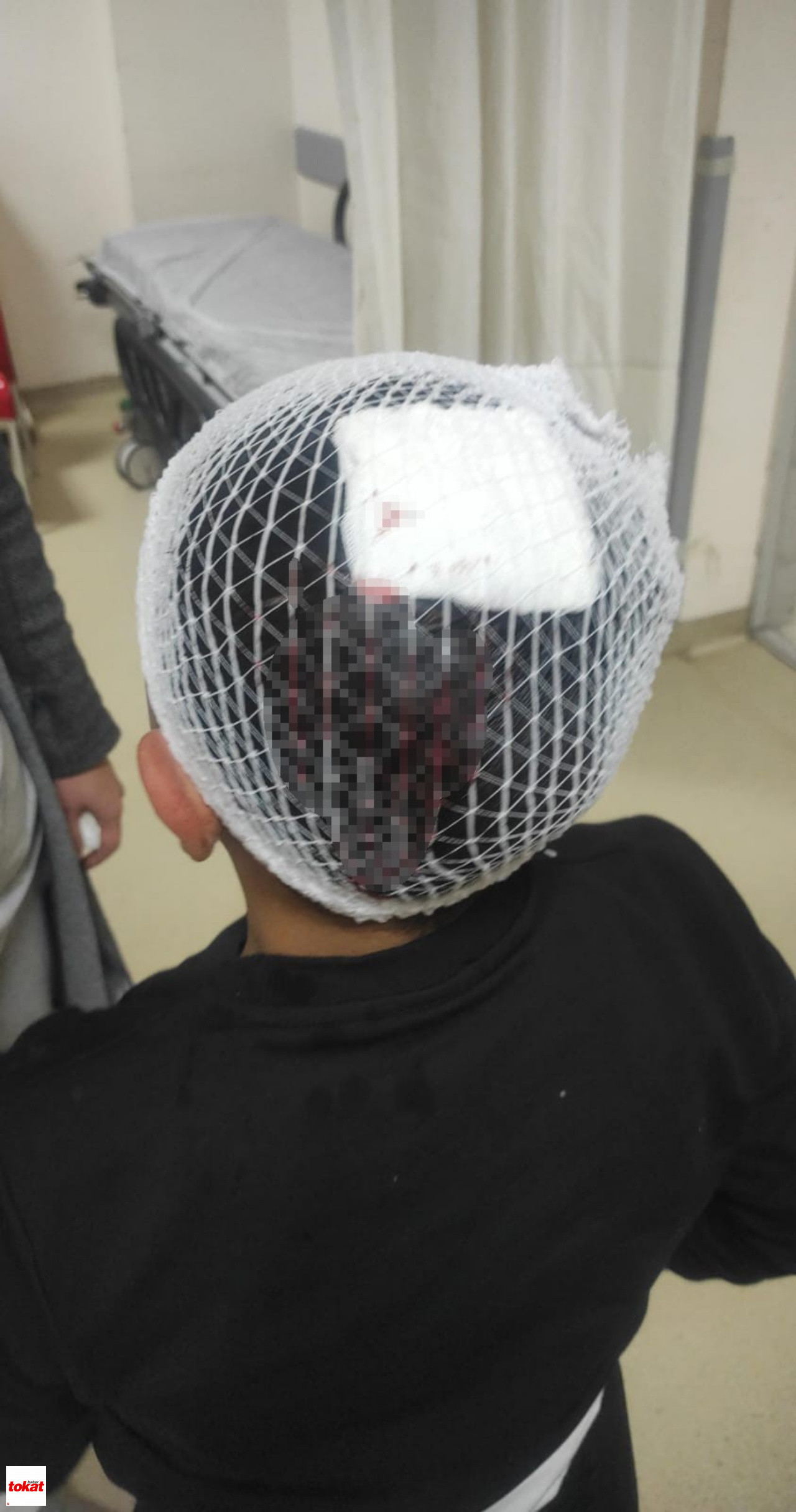 Şampiyonluk Kutlamasında Havai Fişek 9 Yaşındaki Çocuğun Kafasına Isabet Etti2