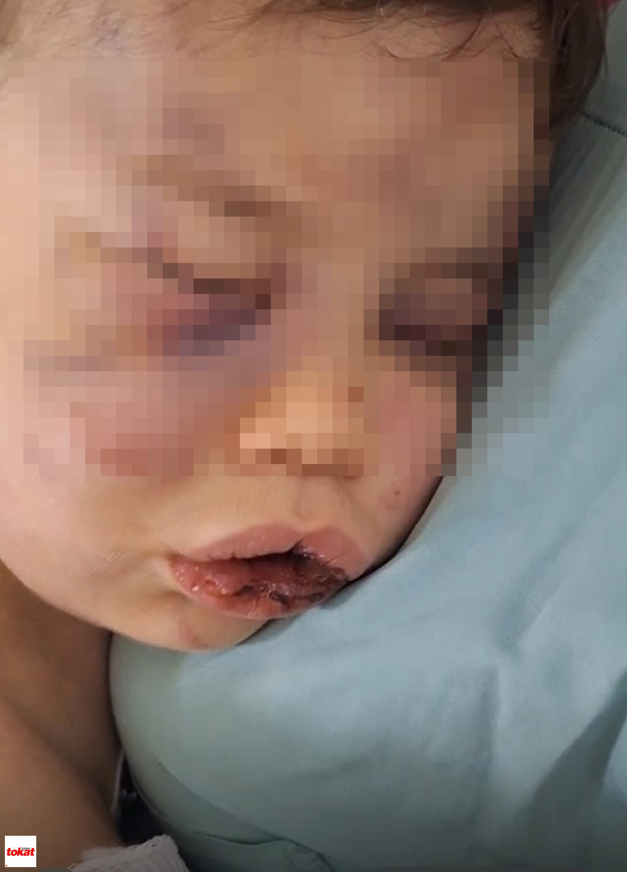 Vahşeti Yaşayan 2 Yaşındaki Bebek Hastanelik Oldu