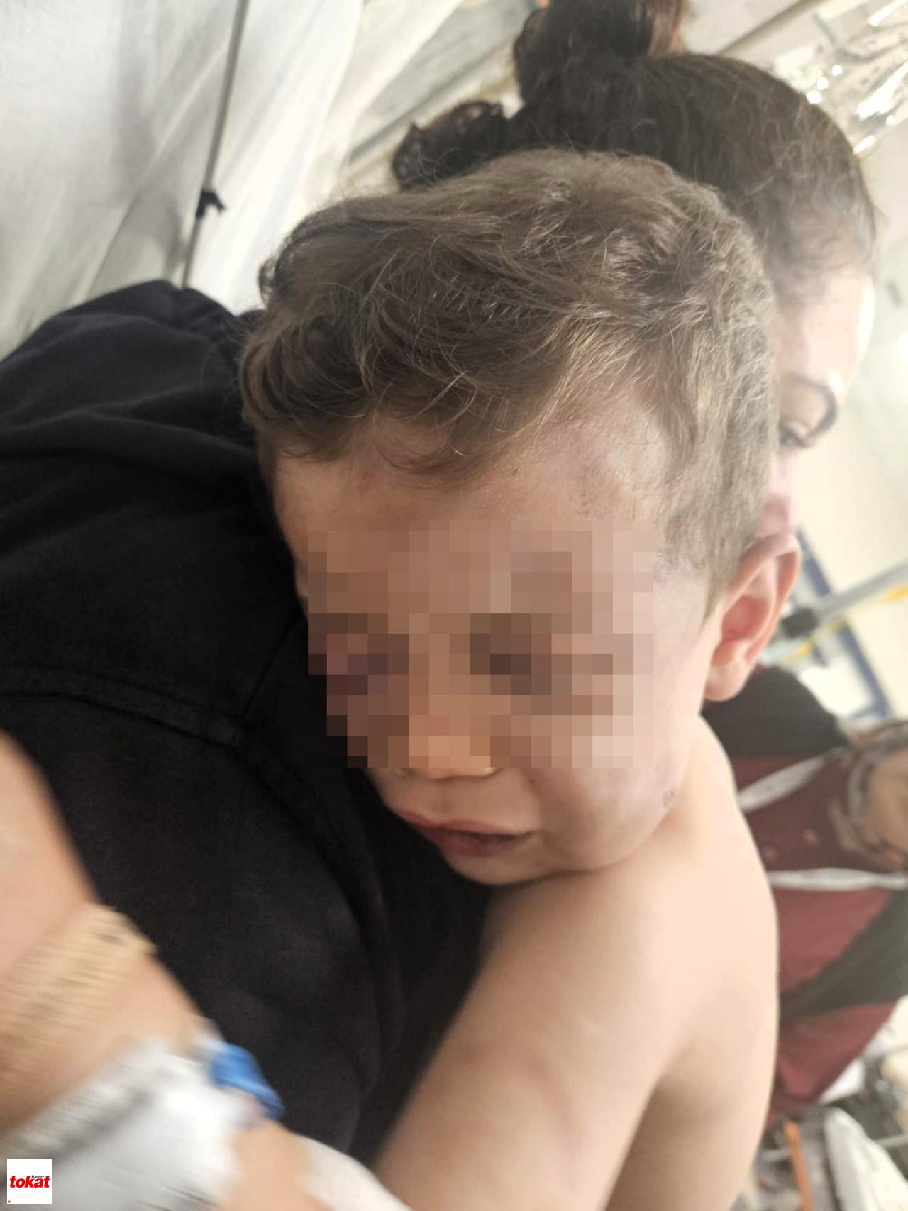 Vahşeti Yaşayan 2 Yaşındaki Bebek Hastanelik Oldu1