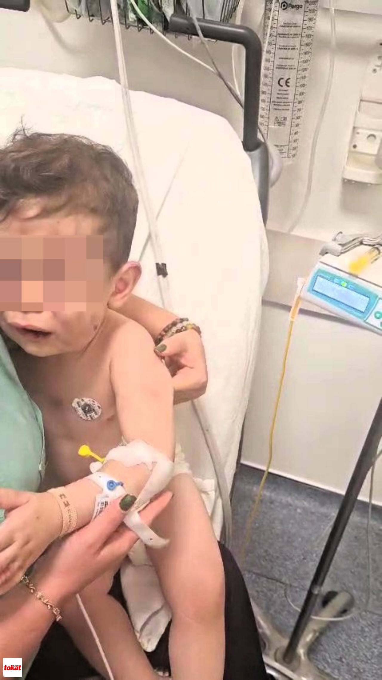 Vahşeti Yaşayan 2 Yaşındaki Bebek Hastanelik Oldu2