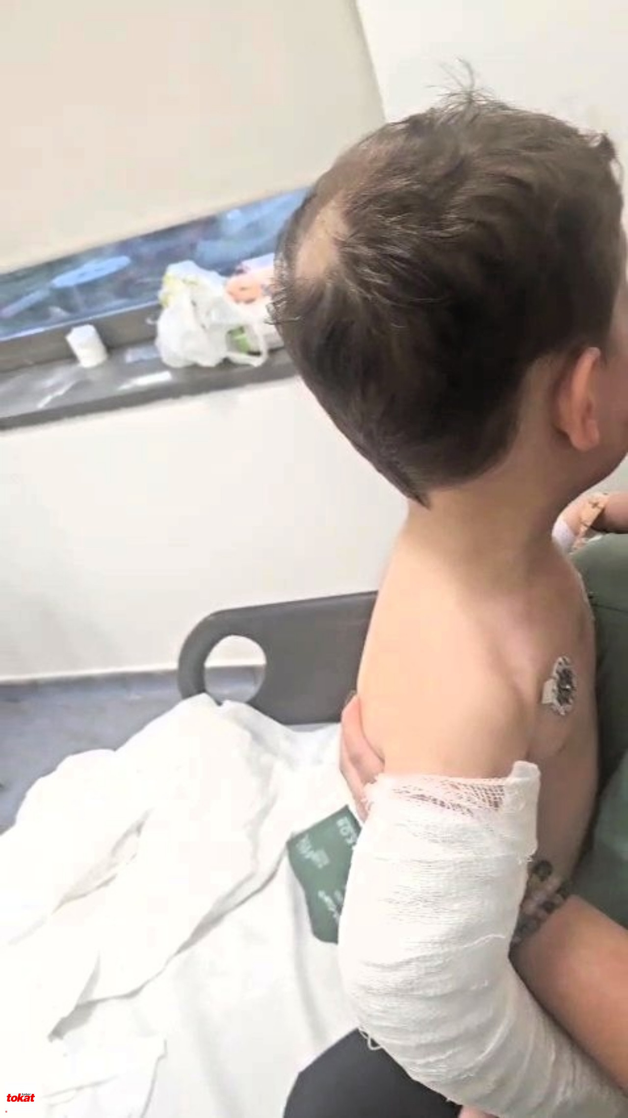 Vahşeti Yaşayan 2 Yaşındaki Bebek Hastanelik Oldu3