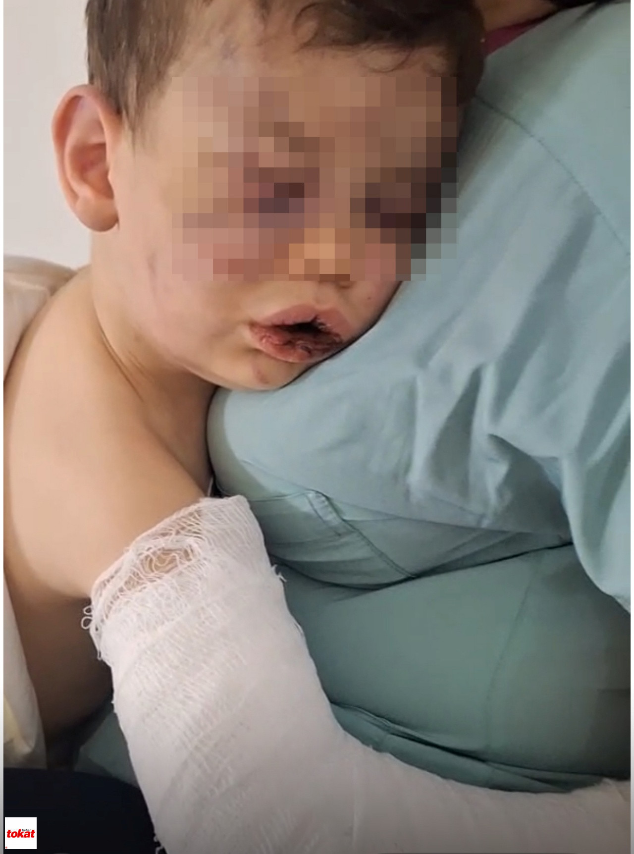 Vahşeti Yaşayan 2 Yaşındaki Bebek Hastanelik Oldu4