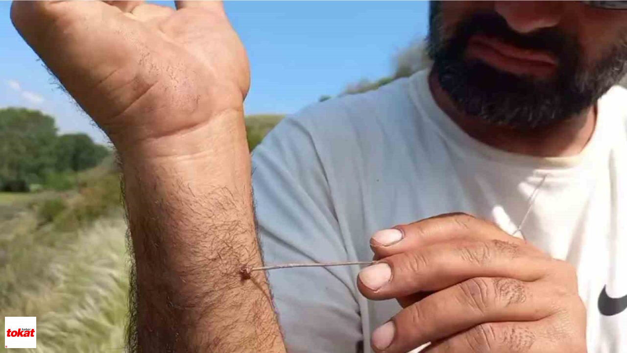 Kenelerle Yaşamak Kene Vücutta Ne Kadar Süre Kalırsa Tehlikeli Olur