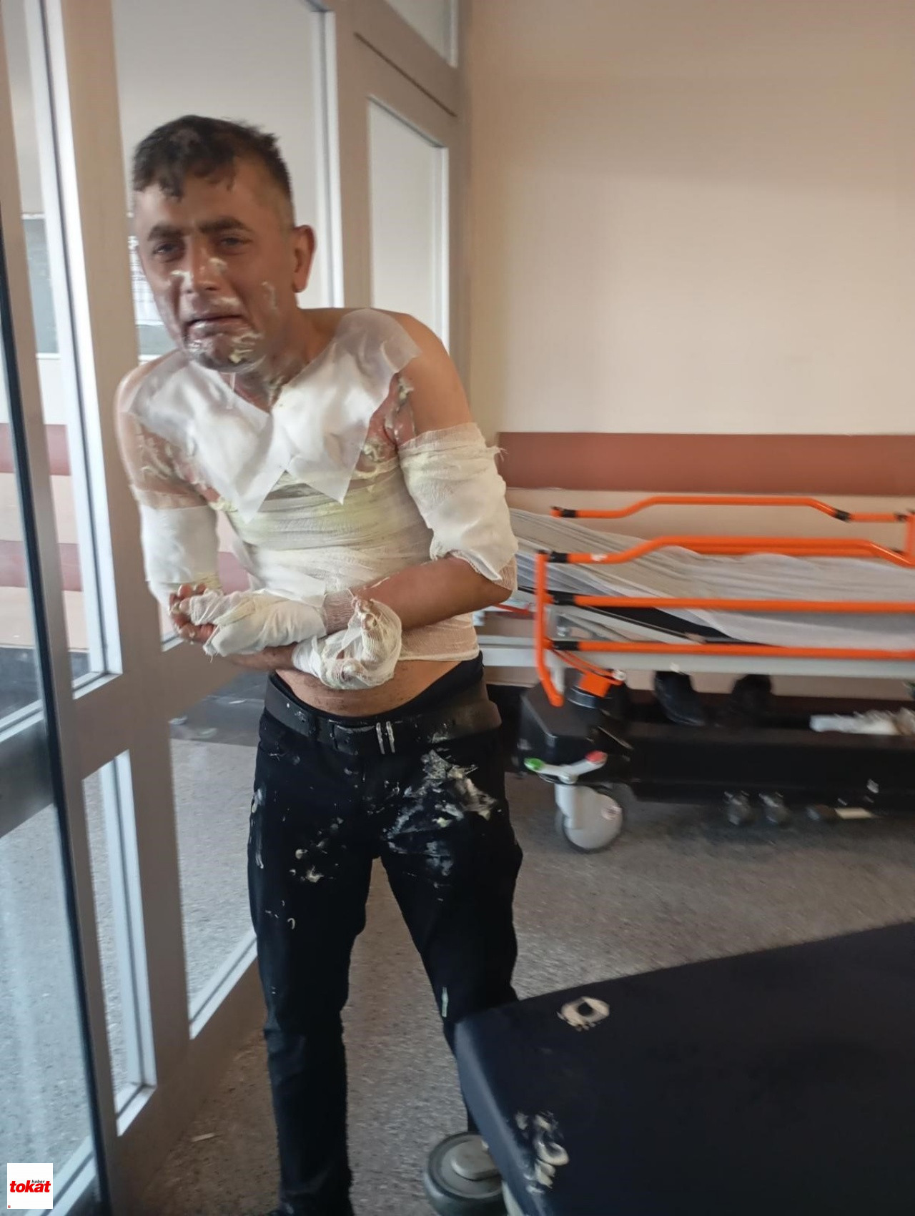Engelli Vatandaş Dehşeti Yaşadı Telefonunu Çaldı, Şikayet Edince Benzin Döküp Yaktı4